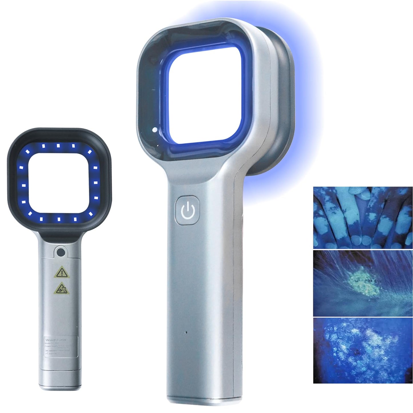 Portable Woods Lamp Skin Analyzer, Professional Facial Magnifying Analyzer,Rechargeable Woods Lamp for Skin Testing Home Care Salon SPA Machine(Grey)